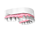Implant Dentaire
