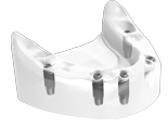 Implant Dentaire