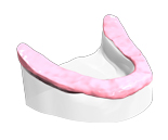 Implant Dentaire